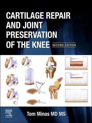cover image of Cartilage Repair and Joint Preservation of the Knee